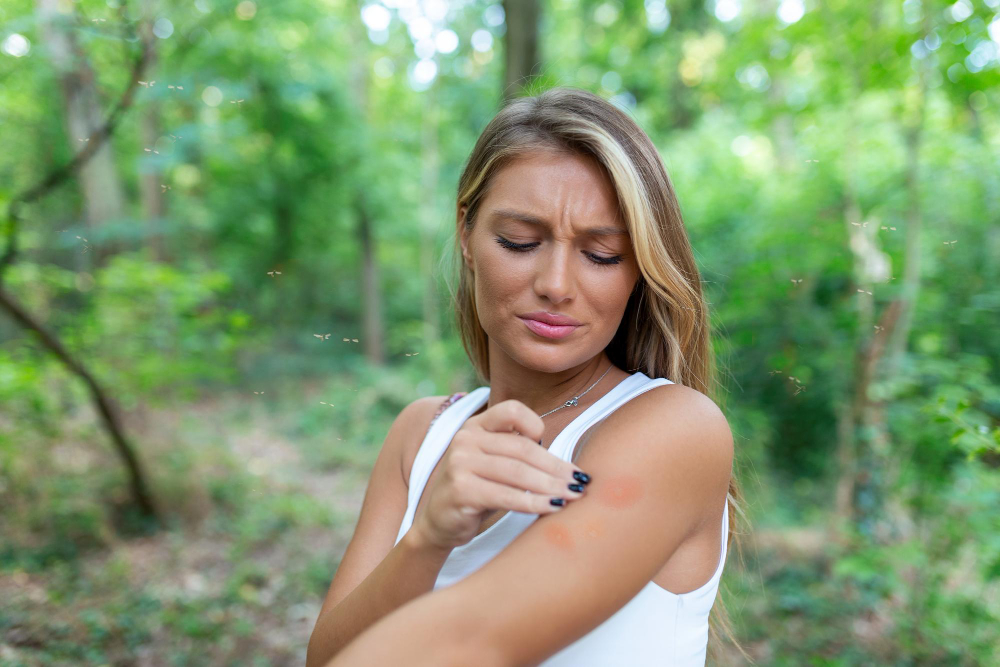 Na Hmyzí Bodnutí Může Vzniknout Menší I Větší Alergická Reakce Inspirace 6303